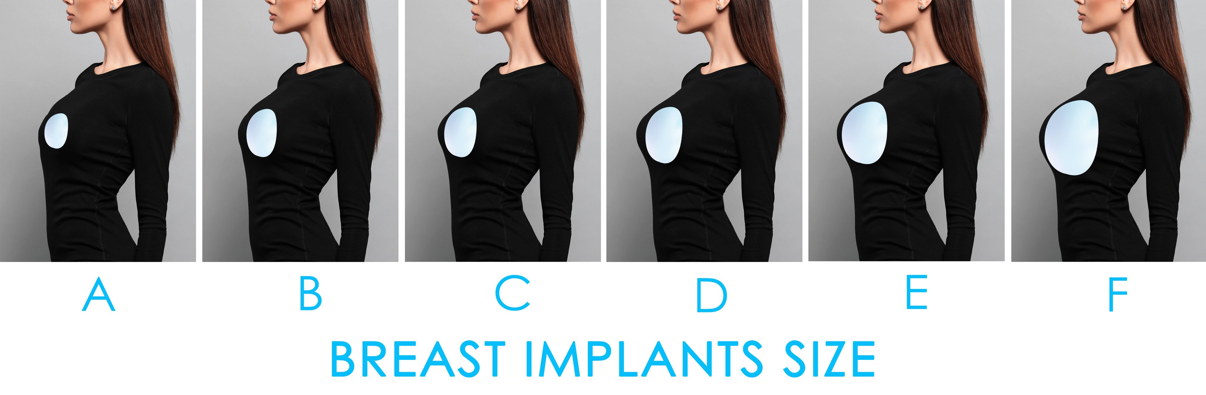 types-of-breast-implants